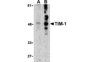 Western blot analysis of TIM-1 in human uterus tissue lysate with this product at (A) 1 and (B) 2 μg/ml. (HAVCR1 antibody  (N-Term))