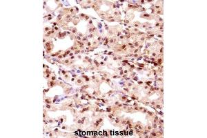 Immunohistochemistry (IHC) image for anti-Thymopoietin (TMPO) antibody (ABIN2998199) (Thymopoietin antibody)