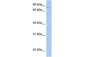 WB Suggested Anti-LRRC33 Antibody Titration: 0. (LRRC33 antibody  (Middle Region))