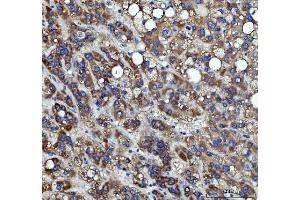 IHC analysis of RRS1 using anti-RRS1 antibody (ABIN7602918). (RRS1 antibody  (C-Term))