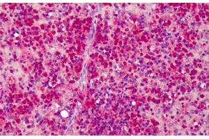 Human Spleen: Formalin-Fixed, Paraffin-Embedded (FFPE) (beta Actin antibody  (C-Term))