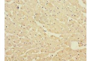 Immunohistochemistry of paraffin-embedded human heart tissue using ABIN7150306 at dilution of 1:100