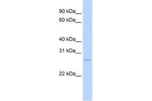 Western Blotting (WB) image for anti-RNA Binding Motif Protein 38 (RBM38) antibody (ABIN2462271) (RBM38 antibody)