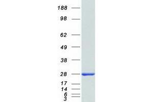 Validation with Western Blot (CDKN2D Protein (Transcript Variant 1) (Myc-DYKDDDDK Tag))