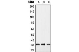 Western blot analysis of Connexin 31. (GJB5 antibody  (Center))
