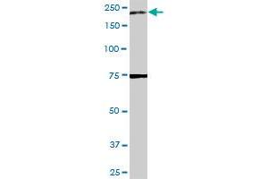 A2M MaxPab rabbit polyclonal antibody. (alpha 2 Macroglobulin antibody  (AA 1-1474))
