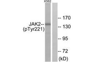 Western blot analysis of extracts from K562 cells, using JAK2 (Phospho-Tyr221) Antibody.