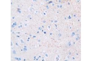 Used in DAB staining on fromalin fixed paraffin- embedded Kidney tissue (GDF10 antibody  (AA 1-288))