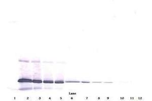 Image no. 4 for anti-Interleukin 11 (IL11) antibody (ABIN465144) (IL-11 antibody)