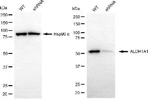 Western blotting analysis using ALDH1A1 antibody (ABIN7797555). (ALDH1A1 antibody)