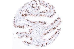 Strong nuclear PAX8 staining of a subset of epithelial cells in the fallopian tube (Recombinant PAX8 antibody)