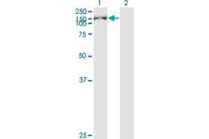 Western Blotting (WB) image for anti-Cell Migration Inducing Hyaluronan Binding Protein (CEMIP) (AA 880-979) antibody (ABIN528141)
