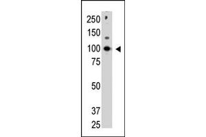Image no. 1 for anti-Cbl proto-oncogene C (CBLC) (C-Term) antibody (ABIN356779) (CBLC antibody  (C-Term))