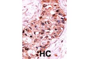 Immunohistochemistry (Paraffin-embedded Sections) (IHC (p)) image for anti-Caspase 9, Apoptosis-Related Cysteine Peptidase (CASP9) (pSer196) antibody (ABIN389526)