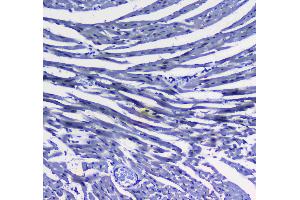 IHC analysis of MAX using anti-MAX antibody . (MAX antibody  (AA 30-106))
