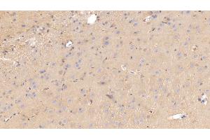 Detection of APOE in Rat Cerebrum Tissue using Monoclonal Antibody to Apolipoprotein E (APOE)