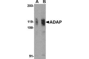 Western Blotting (WB) image for anti-FYN-Binding Protein (FYB) (N-Term) antibody (ABIN1031214) (FYB antibody  (N-Term))