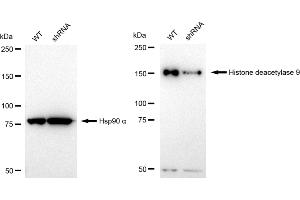 Western blotting analysis using Histone deacetylase 9 antibody (ABIN7798938).