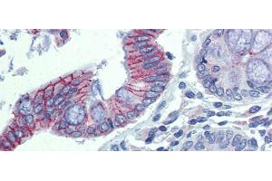 Immunohistochemistry with Human Colon lysate tissue at an antibody concentration of 5. (Desmoglein 2 antibody  (N-Term))