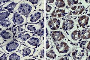 Paraffin embedded human kidney cancer tissue was stained with Mouse IgG2a-UNLB isotype control, DAB, and hematoxylin.