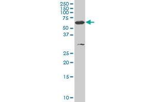 SMARCD3 monoclonal antibody (M03A), clone 5G4 Western Blot analysis of SMARCD3 expression in K-562 .