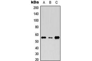 Western blot analysis of Rhotekin expression in HeLa (A), Raw264. (Rhotekin antibody  (Center))