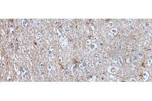 Immunohistochemistry of paraffin-embedded Human brain tissue using BMP1 Polyclonal Antibody at dilution of 1:105(x200) (BMP1 antibody)