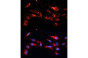 Immunofluorescence (IF) image for anti-Microtubule-Associated Protein 1B (MAP1B) (AA 1820-2100) antibody (ABIN1680748)