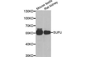 Western blot analysis of extracts of various cell lines, using SUFU antibody (ABIN5974087) at 1/1000 dilution. (SUFUH antibody)