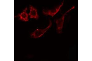ABIN6274866 staining Hela cells by IF/ICC. (Arylsulfatase E antibody  (Internal Region))