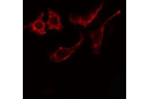 ABIN6274866 staining Hela cells by IF/ICC.