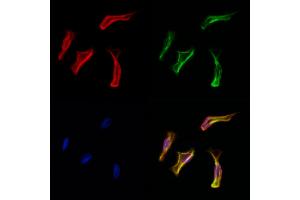 ABIN6261469 and ABIN6278061 staining Hela cells by IF/ICC. (EHD1 antibody  (C-Term))
