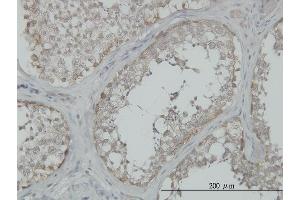 Immunoperoxidase of monoclonal antibody to MAP3K4 on formalin-fixed paraffin-embedded human testis. (MAP3K4 antibody  (AA 1201-1300))