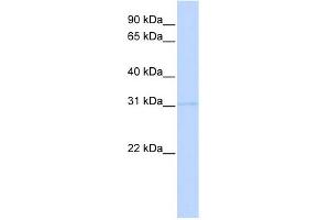 WB Suggested Anti-PRMT6 Antibody Titration:  0. (PRMT6 antibody  (Middle Region))