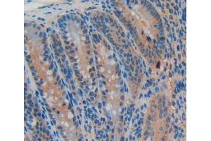 Used in DAB staining on fromalin fixed paraffin- embedded intestine tissue (CDKN2B antibody  (AA 1-130))