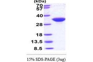 SDS-PAGE (SDS) image for Inositol(myo)-1(or 4)-Monophosphatase 1 (IMPA1) (AA 1-277) protein (His tag) (ABIN667229) (IMPA1 Protein (AA 1-277) (His tag))