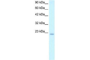Human Daudi; WB Suggested Anti-POLE3 Antibody Titration: 2. (POLE3 antibody  (N-Term))