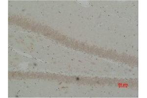 Immunohistochemical analysis of paraffin-embedded Rat Brain Tissue using BEST2 Polyclonal Antibody. (Bestrophin 2 antibody)