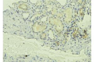 ABIN6277709 at 1/100 staining Mouse kidney tissue by IHC-P. (Chloride Channel 5 antibody  (Internal Region))