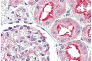 Human Kidney (formalin-fixed, paraffin-embedded) stained with ATG7 antibody ABIN307176 at 5 ug/ml followed by biotinylated goat anti-rabbit IgG secondary antibody ABIN481713, alkaline phosphatase-streptavidin and chromogen.