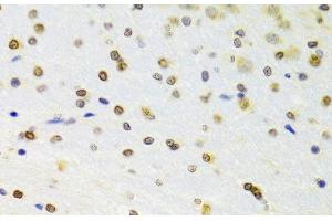 Immunohistochemistry of paraffin-embedded Rat brain using DOK1 Polyclonal Antibody at dilution of 1:100 (40x lens). (DOK1 antibody)