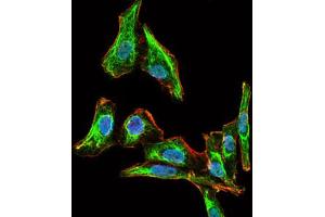 Image no. 2 for anti-Maternal Embryonic Leucine Zipper Kinase (MELK) antibody (ABIN1491623) (MELK antibody)