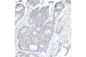 Immunohistochemistry (IHC) image for anti-Notch 1 (NOTCH1) (AA 2505-2555) antibody (ABIN7454790) (Notch1 antibody  (AA 2505-2555))