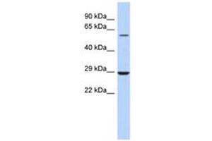 Image no. 1 for anti-Lysophosphatidylcholine Acyltransferase 1 (LPCAT1) (AA 323-372) antibody (ABIN6743531) (LPCAT1 antibody  (AA 323-372))