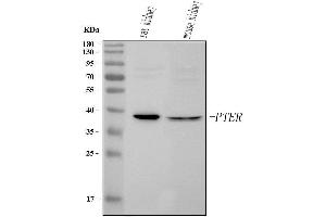 anti-Phosphotriesterase Related (PTER) (AA 1-315) antibody