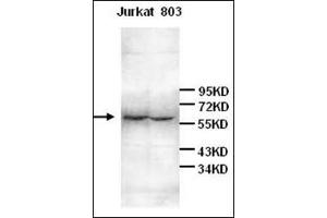 Western Blot analysis of Jurkat and 803 cell lysates with anti-IL6R antibody at 1/200 dilution (IL-6 Receptor antibody)