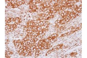 Image no. 1 for anti-Tubulin, beta 2C (TUBB2C) (Internal Region) antibody (ABIN1493535) (TUBB2C antibody  (Internal Region))
