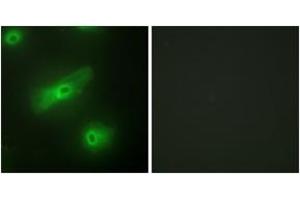 Immunofluorescence analysis of HeLa cells, using TALL-2 Antibody. (TNFSF13 antibody  (AA 151-200))