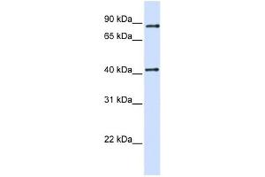 TXNDC13 antibody used at 1 ug/ml to detect target protein. (TMX4 antibody  (C-Term))