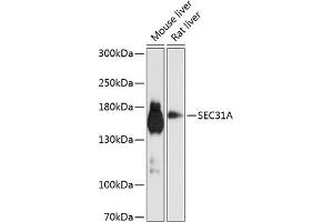 Western blot analysis of extracts of various cell lines, using SEC31A antibody (ABIN6132940, ABIN6147491, ABIN6147492 and ABIN6224974) at 1:1000 dilution.